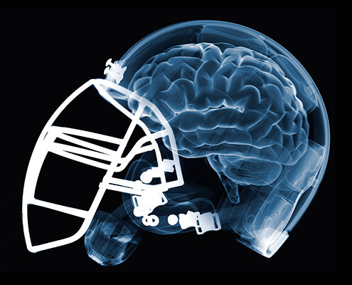 concussion and fatigue